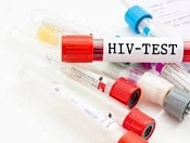 Где сдать экспресс-тест на ВИЧ в октябре